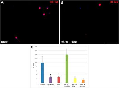 Plasma Rich in Growth Factors (PRGF) Increases the Number of Retinal Müller Glia in Culture but Not the Survival of Retinal Neurons